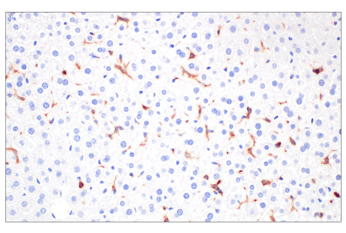Immunohistochemistry Image 7: DAP12 (F1Q2P) Rabbit Monoclonal Antibody