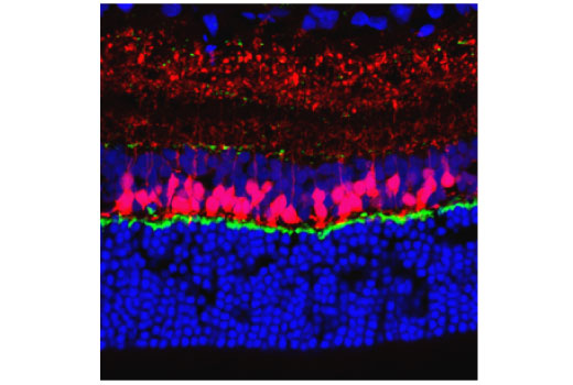 Immunofluorescence Image 2: PSD95 (7E3) Mouse Monoclonal Antibody