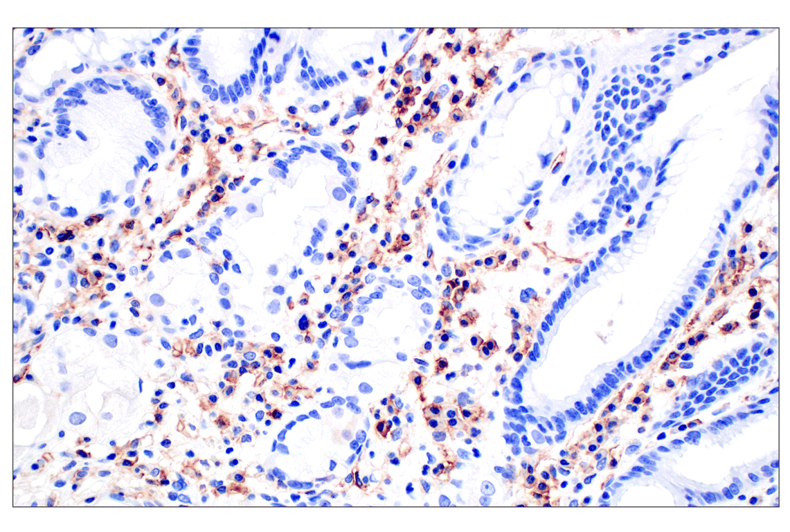 Immunohistochemistry Image 11: CD31 (PECAM-1) (F8M3S) Rabbit Monoclonal Antibody