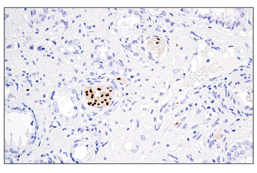Immunohistochemistry Image 5: Sox10 (E6B6I) XP<sup>®</sup> Rabbit mAb