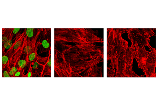 Immunofluorescence Image 1: Histone H3 (K27M Mutant Specific) (D3B5T) Rabbit mAb (Alexa Fluor<sup>®</sup> 488 Conjugate)