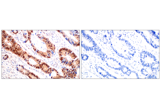 undefined Image 30: CRL4/CRBN Targeted Protein Degradation Complex Antibody Sampler Kit