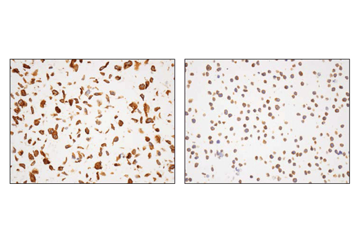 Immunohistochemistry Image 1: alpha-Actinin 4 (D7U5A) Rabbit Monoclonal Antibody 