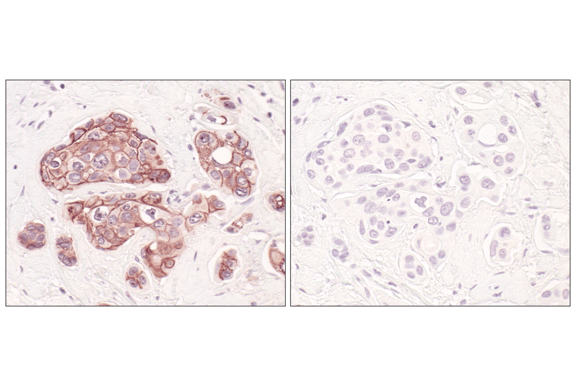 Immunohistochemistry Image 8: E-Cadherin (24E10) Rabbit Monoclonal Antibody