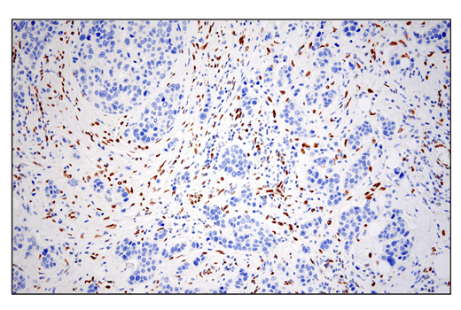 Immunohistochemistry Image 2: ZEB1 (E2G6Y) Rabbit Monoclonal Antibody (BSA and Azide Free)