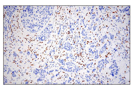 Immunohistochemistry Image 2: ZEB1 (E2G6Y) XP<sup>®</sup> Rabbit mAb (BSA and Azide Free)