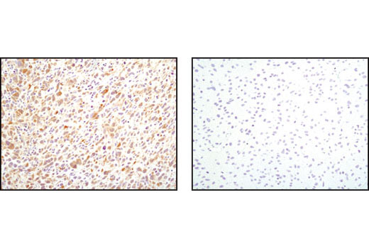 Immunohistochemistry Image 3: PDGF Receptor alpha (D1E1E) Rabbit Monoclonal Antibody (BSA and Azide Free)