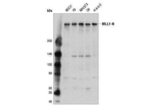 undefined Image 4: SET1/COMPASS Antibody Sampler Kit