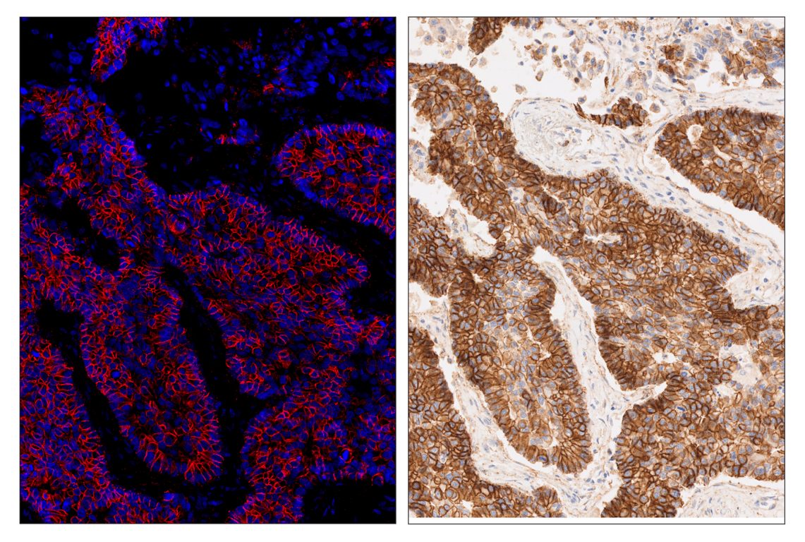 Immunohistochemistry Image 3: N-Cadherin (D4R1H) & CO-0153-647 SignalStar<sup>™</sup> Oligo-Antibody Pair