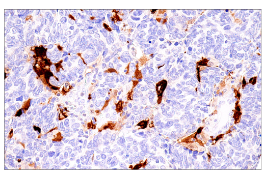 Immunohistochemistry Image 1: S100B (E7C3A) Rabbit Monoclonal Antibody