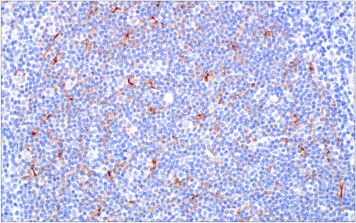 Immunohistochemical analysis of paraffin-embedded  spleen using FoxP3 (D6O8R) Rabbit mAb