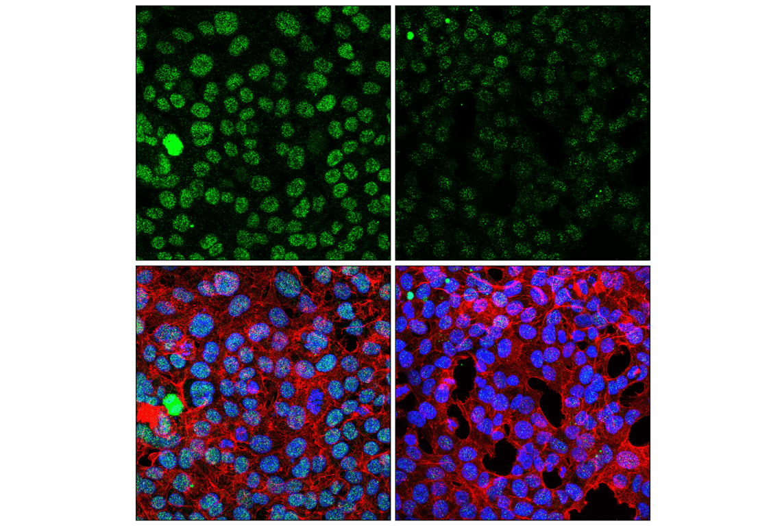 Immunofluorescence Image 1: BRD4 Isoform C (E1Q9N) Rabbit Monoclonal Antibody