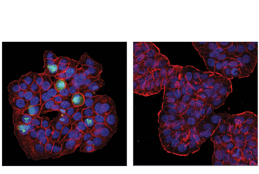 Immunofluorescence Image 1: Phospho-CASC5 (Thr943/Thr1155) (D8D4N) Rabbit Monoclonal Antibody