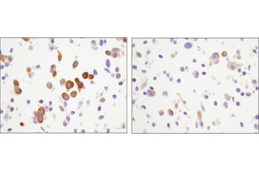 Immunohistochemistry Image 4: Phospho-CAD (Ser1859) (D5K5W) Rabbit Monoclonal Antibody