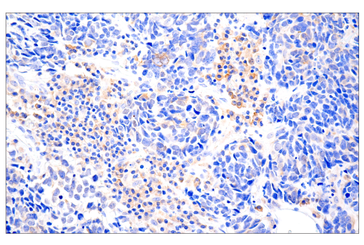 Immunohistochemistry Image 1: cGAS (E5V3W) Rabbit Monoclonal Antibody