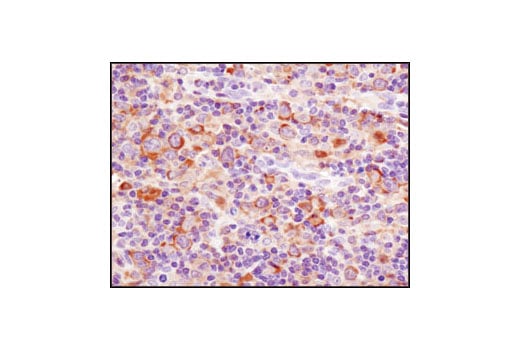 Immunohistochemistry Image 3: PKM2 (D78A4) XP<sup>®</sup> Rabbit mAb (BSA and Azide Free)