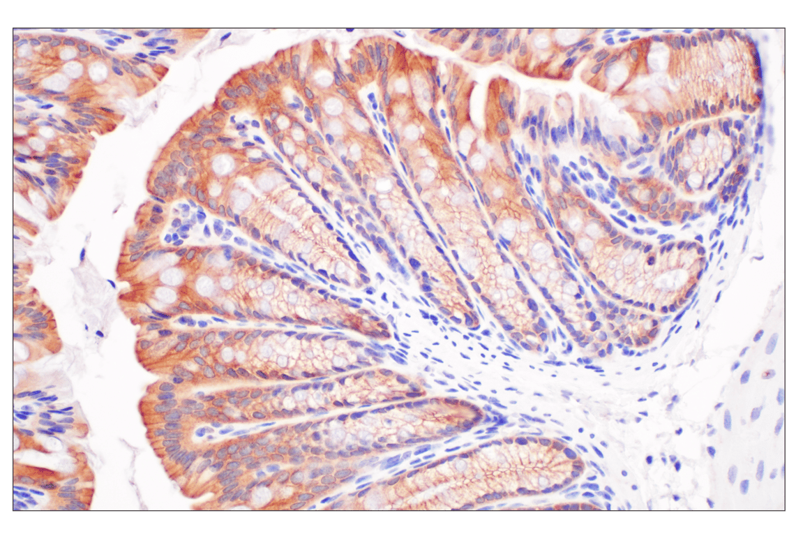 Immunohistochemistry Image 7: Desmoplakin (F3J8Y) Rabbit Monoclonal Antibody