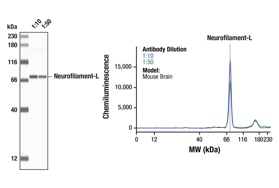 Western Blotting Image 1: Neurofilament-L (E4Z2P) Mouse Monoclonal Antibody