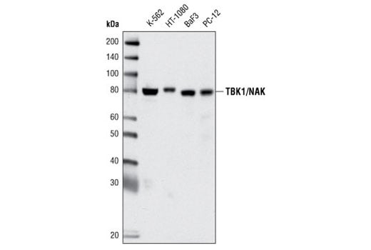 undefined Image 12: Rig-I Pathway Antibody Sampler Kit