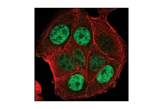 Immunofluorescence Image 1: PA28 gamma Antibody