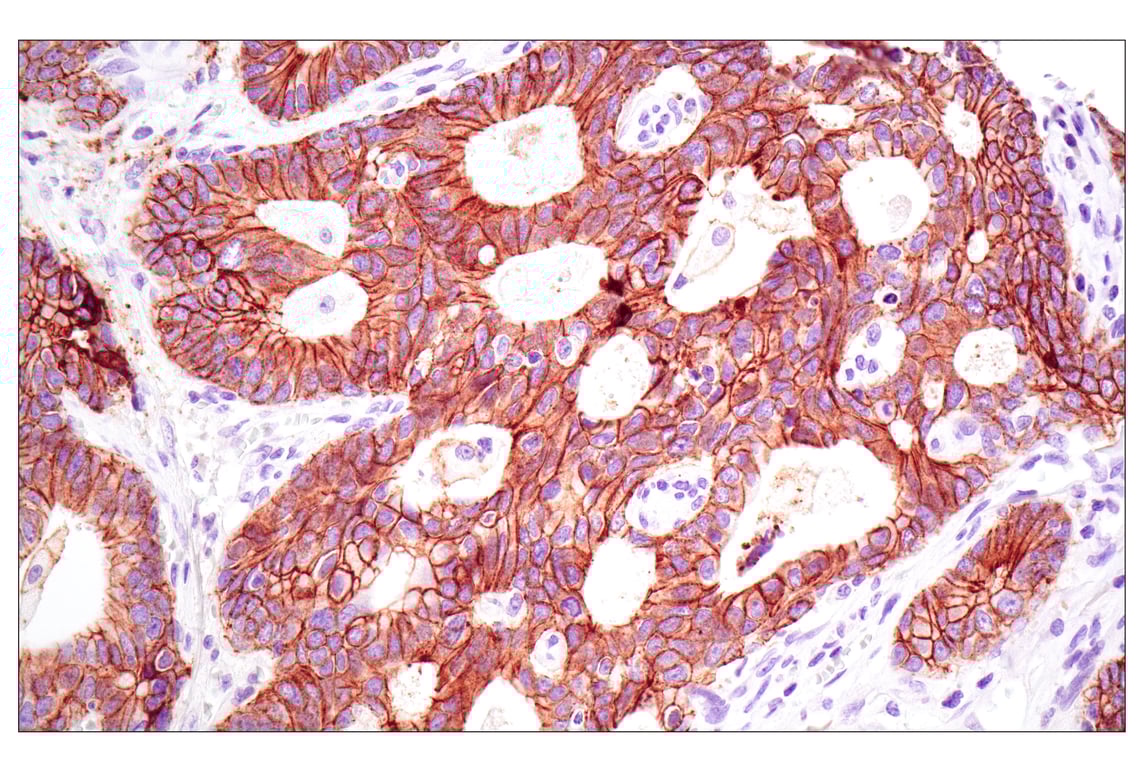 Immunohistochemistry Image 1: E-Cadherin (4A2) Mouse Monoclonal Antibody (BSA and Azide Free)