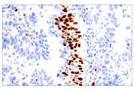 Immunohistochemistry Image 2: p40 (BC28) Mouse Monoclonal Antibody