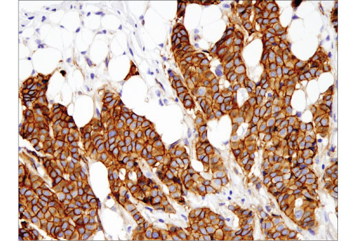 Immunohistochemistry Image 1: γ-Catenin (D9M1Q) Rabbit mAb