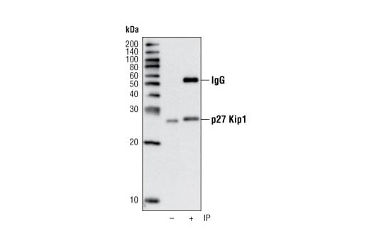 Immunoprecipitation Image 1: p27 Kip1 (D69C12) Rabbit Monoclonal Antibody