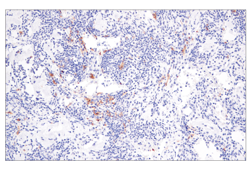 XCR1 (D2F8T) Rabbit mAb (BSA and Azide Free) (#63684