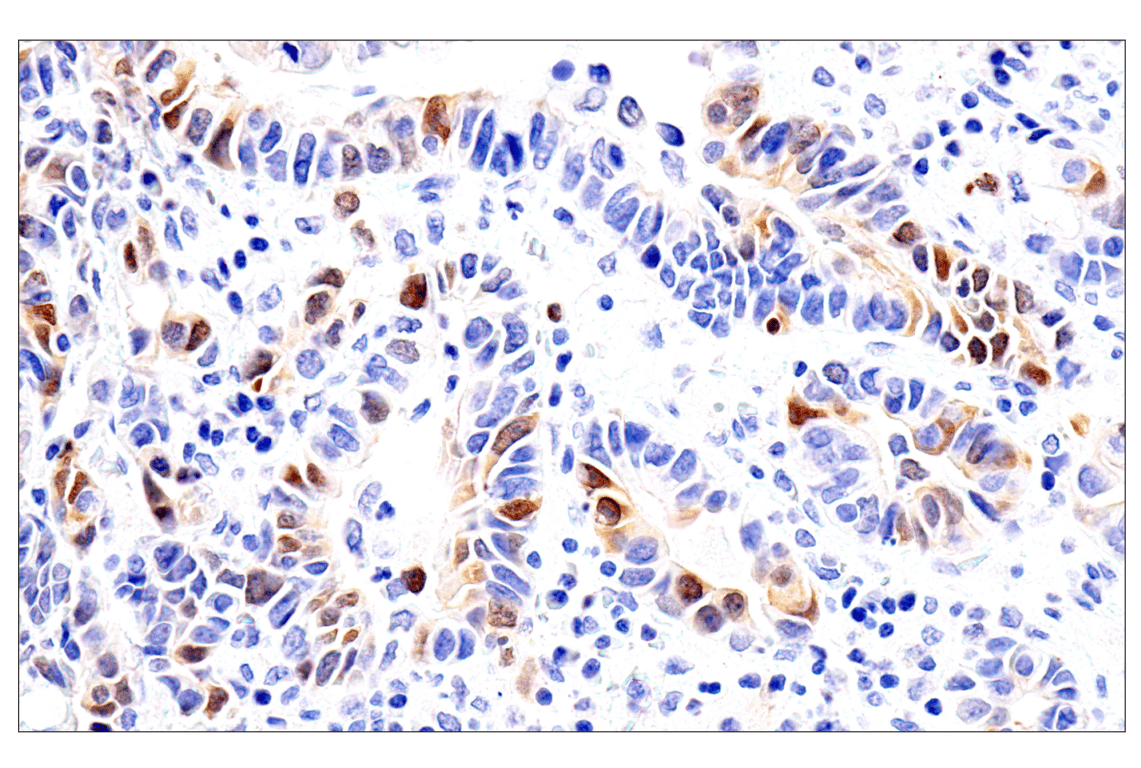 undefined Image 9: PhosphoPlus<sup>®</sup> Chk1 (Ser317) Antibody Duet