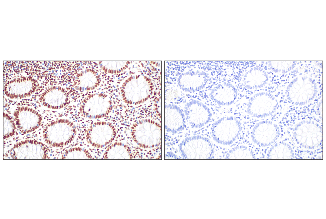 Immunohistochemistry Image 15: CBX7 (E7N1W) Rabbit Monoclonal Antibody