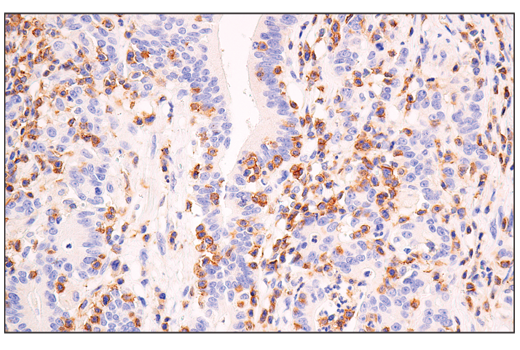 Immunohistochemistry Image 2: Semaphorin-4D/CD100 (E5C3B) Rabbit Monoclonal Antibody (BSA and Azide Free)