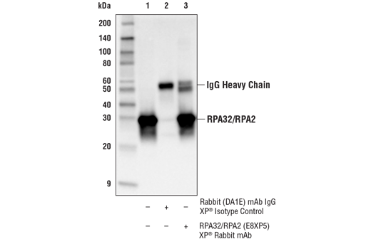 Immunoprecipitation Image 1: RPA32/RPA2 (E8X5P) Rabbit Monoclonal Antibody