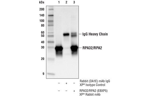 Immunoprecipitation Image 1: RPA32/RPA2 (E8X5P) XP<sup>®</sup> Rabbit mAb