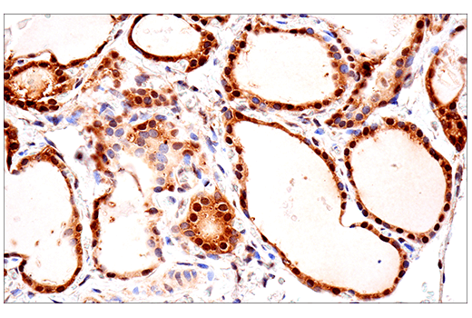 Immunohistochemistry Image 10: SOD1 (E4G1H) Rabbit Monoclonal Antibody