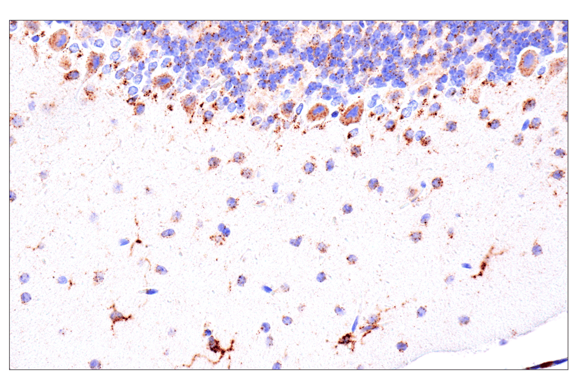 Immunohistochemistry Image 4: HEXB (E9X5S) Rabbit Monoclonal Antibody (BSA and Azide Free)