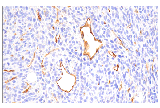Immunohistochemistry Image 2: PLVAP (E4U6V) Rabbit Monoclonal Antibody