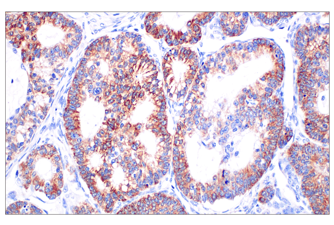 Immunohistochemistry Image 1: CPT1A (E3Y1V) Rabbit Monoclonal Antibody