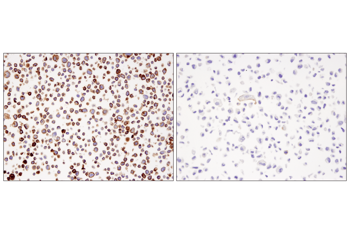 Immunohistochemistry Image 1: PD-L1 (405.9A11) Mouse Monoclonal Antibody (BSA and Azide Free)