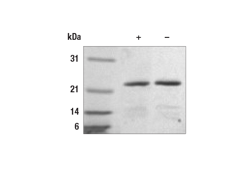undefined Image 2: Human IL-11 Recombinant Protein