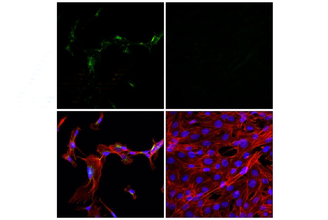 Immunofluorescence Image 1: APP (E3F3P) Rabbit Monoclonal Antibody (BSA and Azide Free)