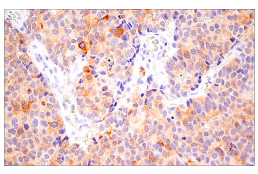 Immunohistochemistry Image 3: CTHRC1 (E8M9S) Rabbit Monoclonal Antibody