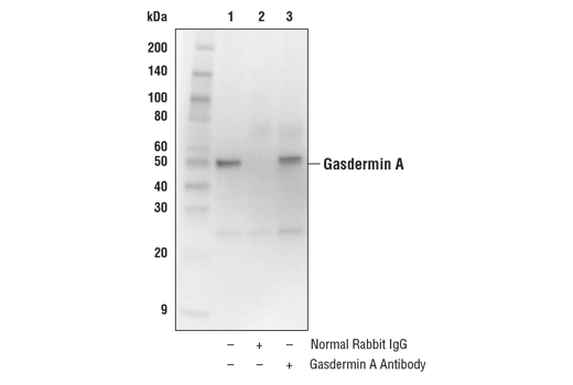 undefined Image 18: Gasdermin Family Antibody Sampler Kit