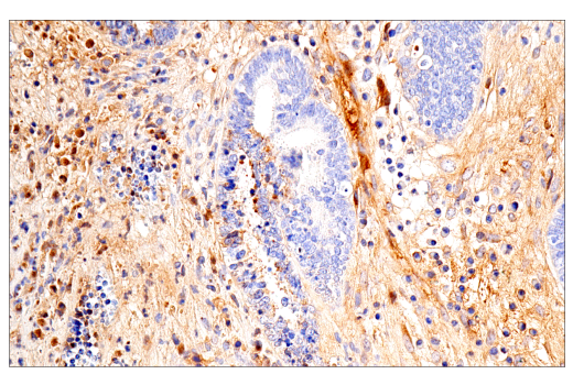 Immunohistochemistry Image 5: IGFBP3 (E6C2E) Rabbit Monoclonal Antibody