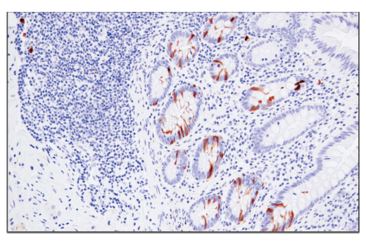 Immunohistochemistry Image 1: RRM2 (E7Y9J) Rabbit Monoclonal Antibody (BSA and Azide Free)