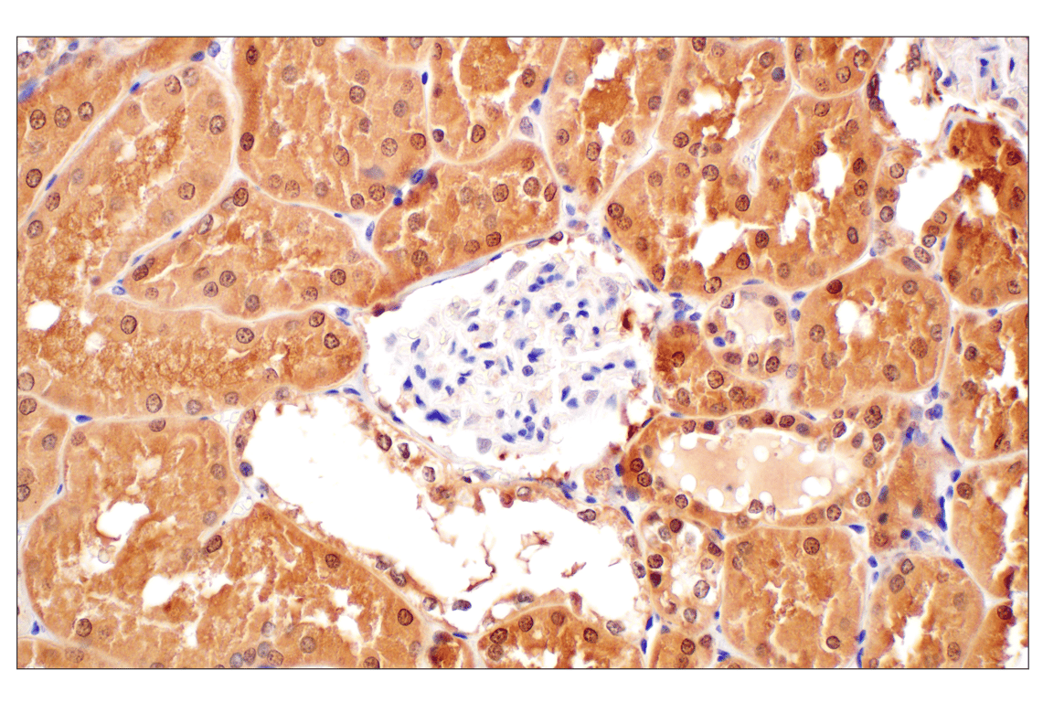 Glutathione Peroxidase 4 Antibody (E5Y8K) Rabbit mAb | Cell