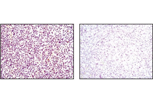 Immunohistochemistry Image 2: p35/25 (C64B10) Rabbit Monoclonal Antibody (BSA and Azide Free)