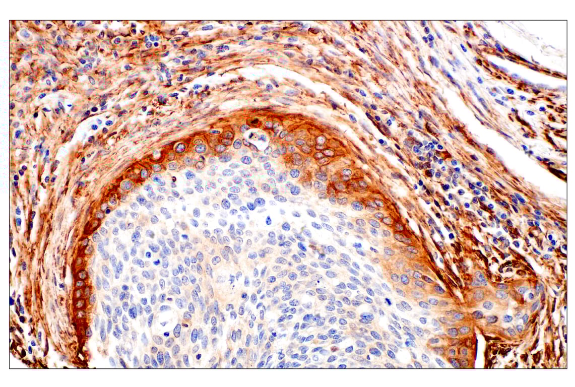Immunohistochemistry Image 2: Filamin A (E8P8M) Rabbit Monoclonal Antibody