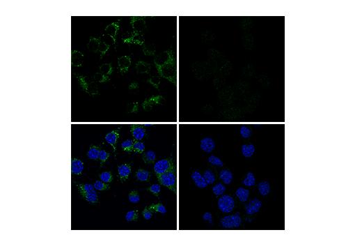 CD68 (E3O7V) Rabbit mAb | Cell Signaling Technology