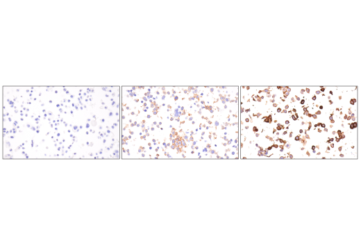 Immunohistochemistry Image 9: Integrin alpha1/CD49a (E9K2J) Rabbit Monoclonal Antibody